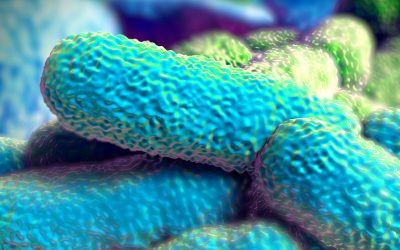 Rischio Legionella